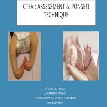Ctev assessment &  ponseti technique