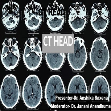CT Head 2 BY JR 1 PGIMER CHANDIGARH.pptx
