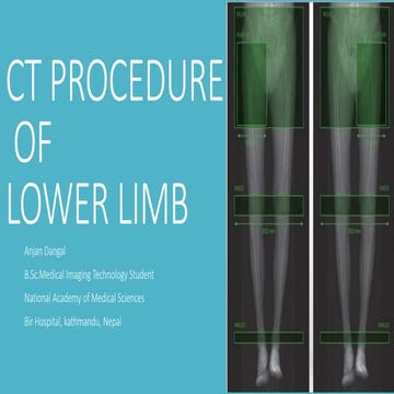 Computed Tomography procedure of lower limb