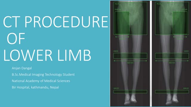 Radiographic Anatomy of the Lower Limbs.pptx