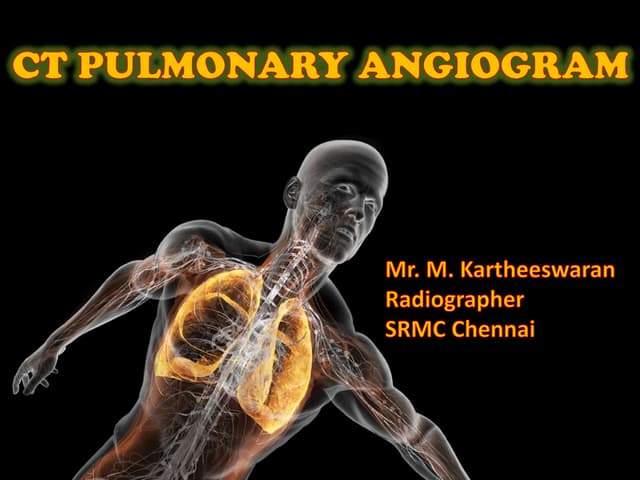 Ct pulmonary angiogram