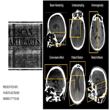 CT-Scan Artifacts and their Types  .pptx