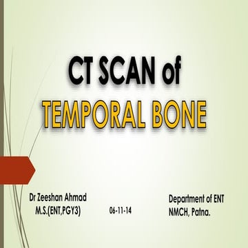 Ct scan temporal bone Dr Zeeshan Ahmad