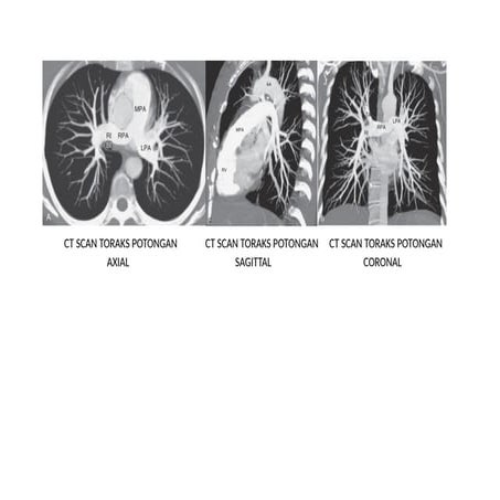 ct-scan-toraks-docx-kjdfkldjrejlkejdlkswejhrjerh-docx