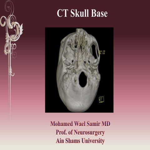 Ct skull base