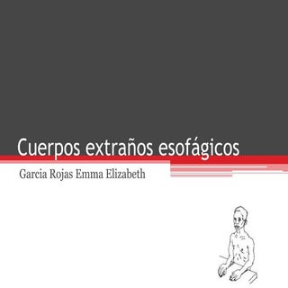 Cuerpos extraños esofágicos