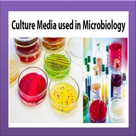 Culture media