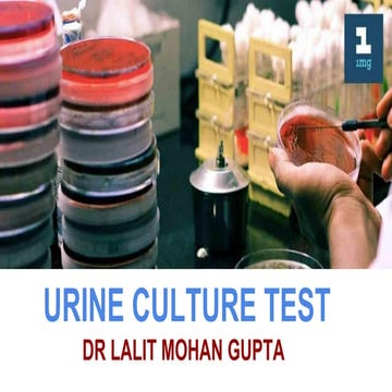 Urine Culture test