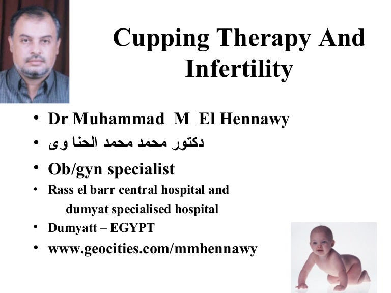 doturi pe varicose hijama varicoză elipsoid