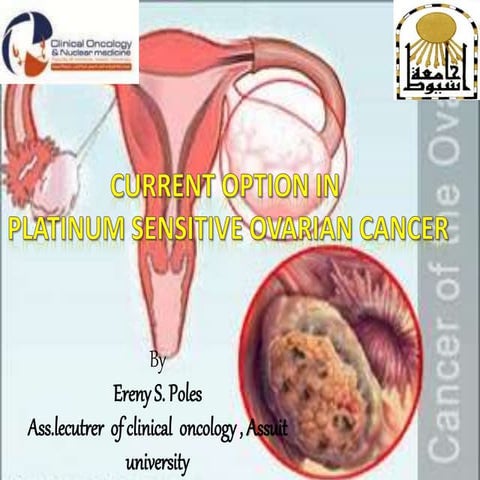 Current option of platinum sensitive ovarian cancer | PPTX