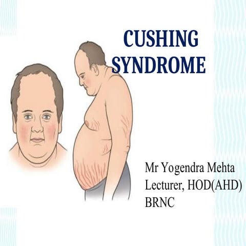 Cushing Syndrome.PPT lecture slide for nursing