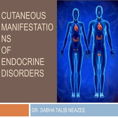 Cutaneous manifestations of endocrine disease