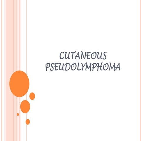 Cutaneous pseudolymphomas