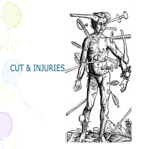 Soft-Tissue Injuries | PPTX