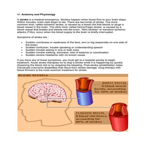 Stoke pathophysiology-1228539935337551-8 | DOC