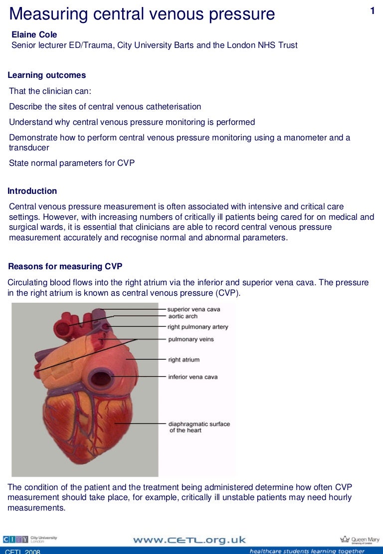 central venous pressure