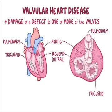 CVS Valvular Disorders -cardiovascular system | PPTX
