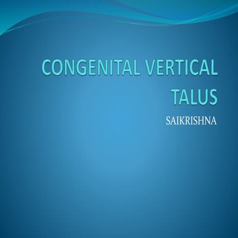 Congenital vertical talus