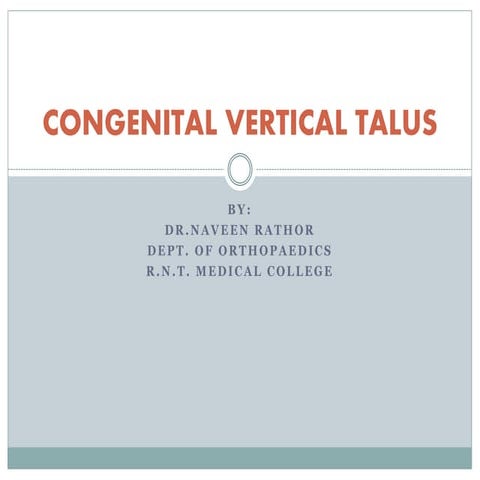 Congenital vertical talus BY DR.NAVEEN RATHOR