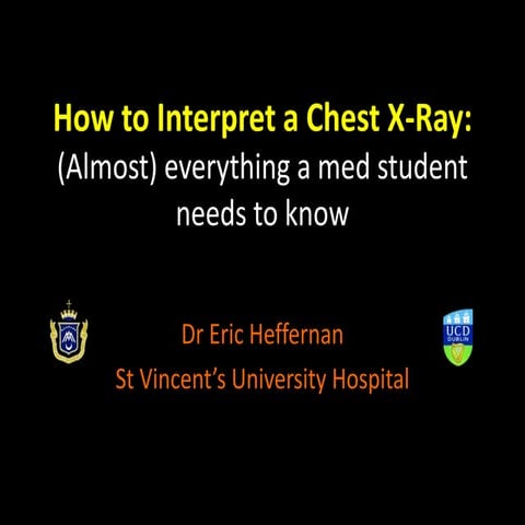 CXR Interpretation for Med Students