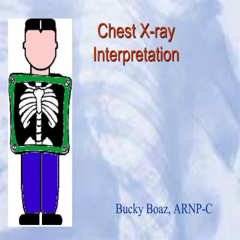 cxr.ppt