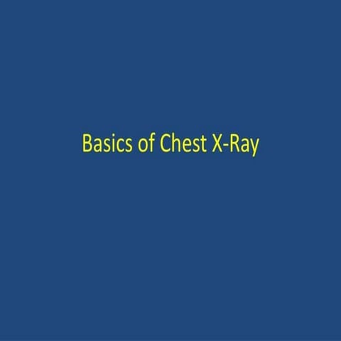 basics about chest x ray for all branches of medical science.pptx