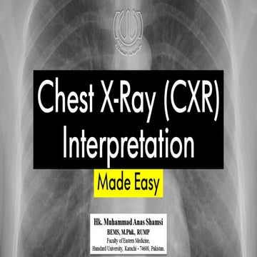 Chest X-Ray (CXR) Interpretation Made Easy: A Comprehensive Guide to Common C...