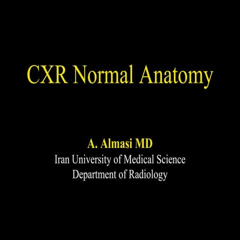 Normal chest x ray- Radiology Basics | PPTX