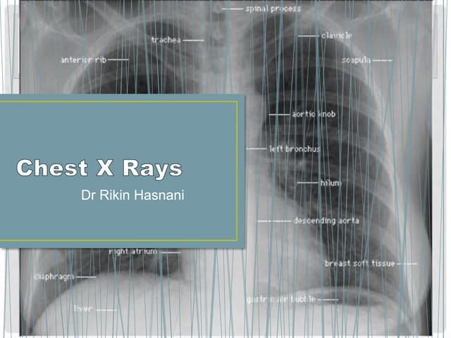 Chest Radiography Positioning And Technique Pptx