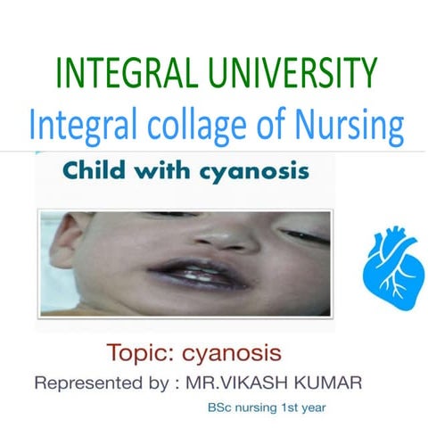 Cyanosis 