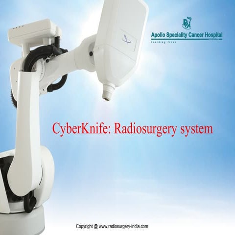 CyberKnife: Radiosurgery System Introduction