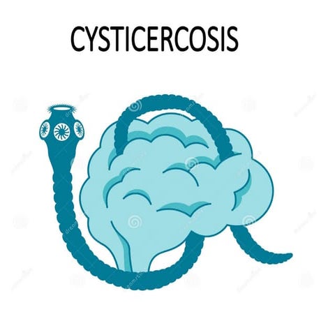 cysticercosis.pptx for medical student.... | PPTX