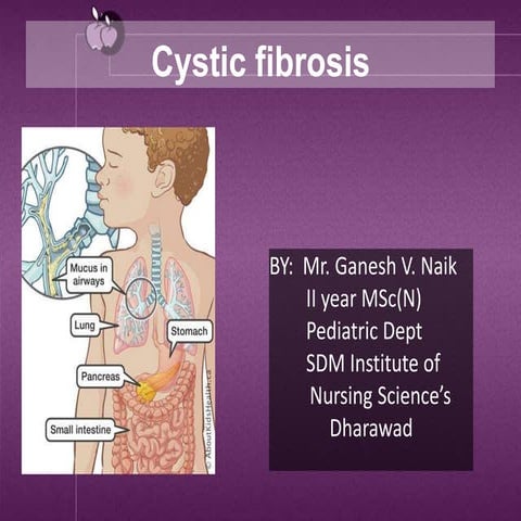 Cystic fibosis