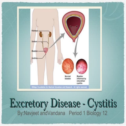 Cystitis | PPT