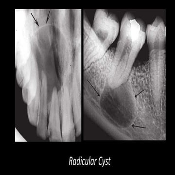 Principles Of Radiographic Interpretation | PPSX