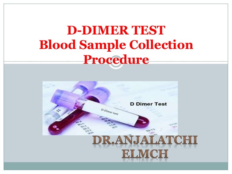 D dimer test and sample collection procedure