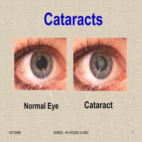 Pupil Dilation Test | PPT