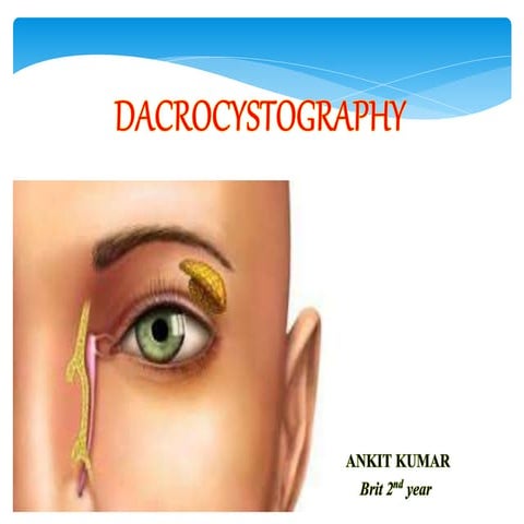 Dacrocystography