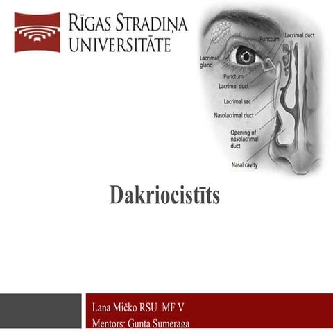 Dakriocistīts.