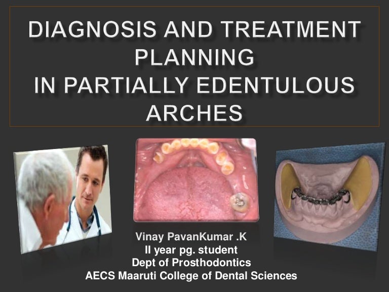 Diagnosis and treatment planning in removable partial denture