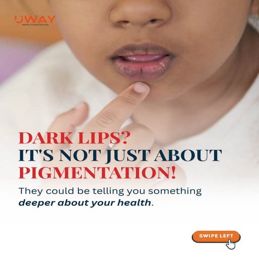Dark lips are not a surface issue — they’re a subtle cry for internal ...
