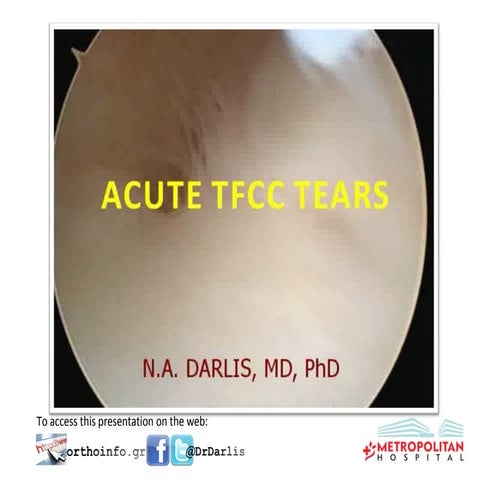 Οξείες Ρήξεις Τρίγωνου Χόνδρου- Acute TFCC Tears 2015