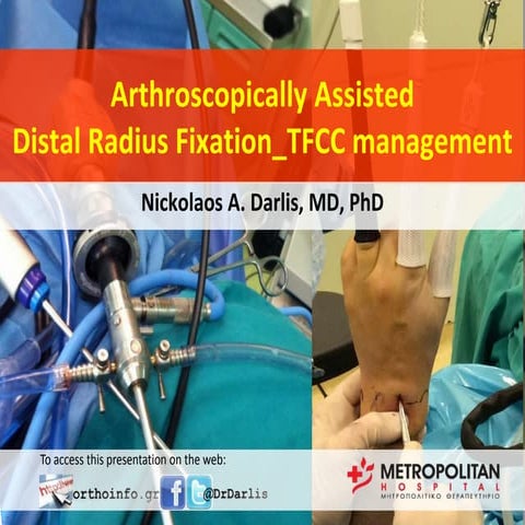 Αρθροσκοπικά Υποβοηθούμενη αντιμετώπιση Καταγμάτων Περιφερικής Κερκίδας και ρ...