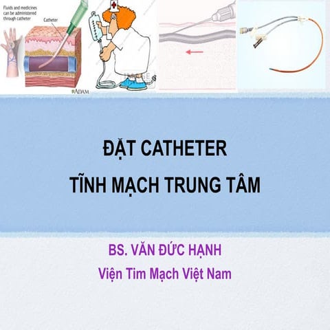 Dat catheter-tinh-mach-trung-tam
