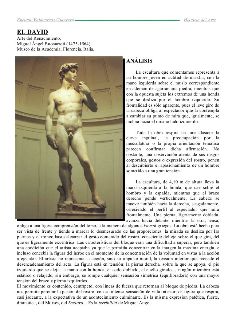 Que Lleva David De Miguel ángel En Su Mano Izquierda David de miguel angel