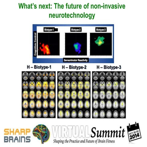 What’s next: The future of non-invasive neurotechnology