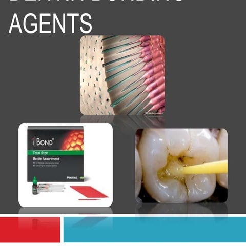 DENTIN BONDING AGENTS