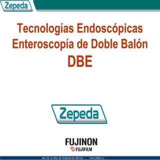 Enteroscopía de Doble Balón