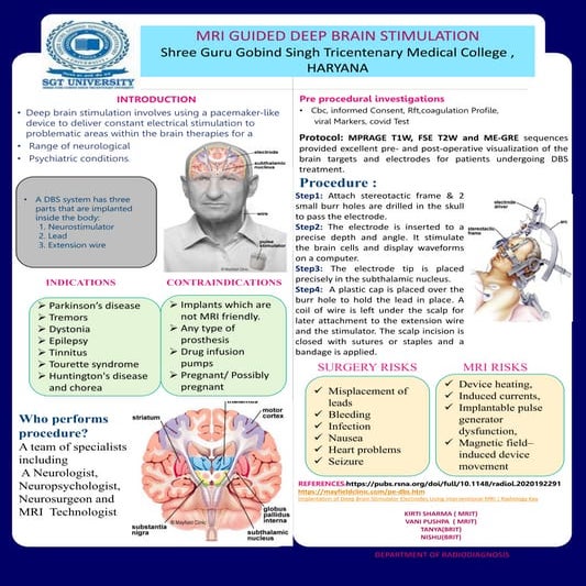 DBS PROTOCOL POSTER.pptx