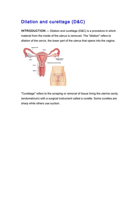Dilatation and curettage | PPT